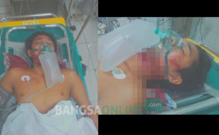 Depresi, Warga Pucangsimo Jombang Gorok Leher Sendiri, Urat Nadi Putus