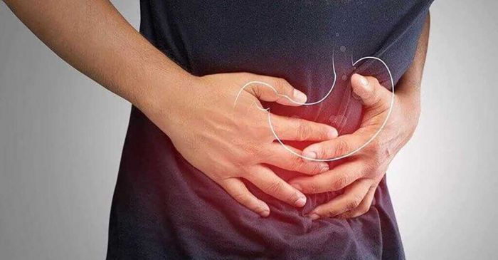 Cara Sederhana Mengontrol Asam Lambung agar Tak Mudah Kambuh