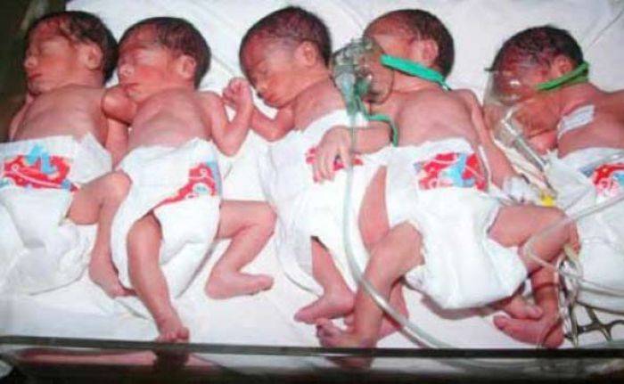 Bayi Kembar Lima di Surabaya Diperiksa dan Dirawat Khusus, Berpotensi Gagal Multi Organ