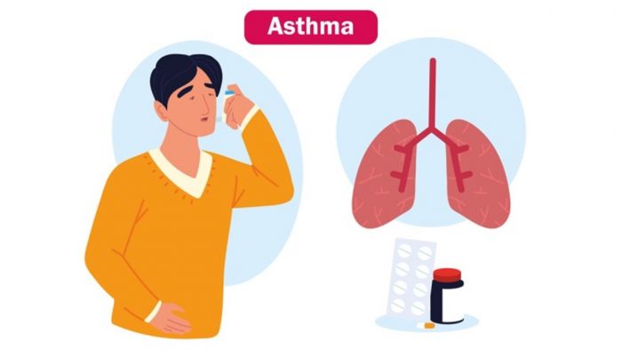 Ketahui 5 Obat Asma Alami