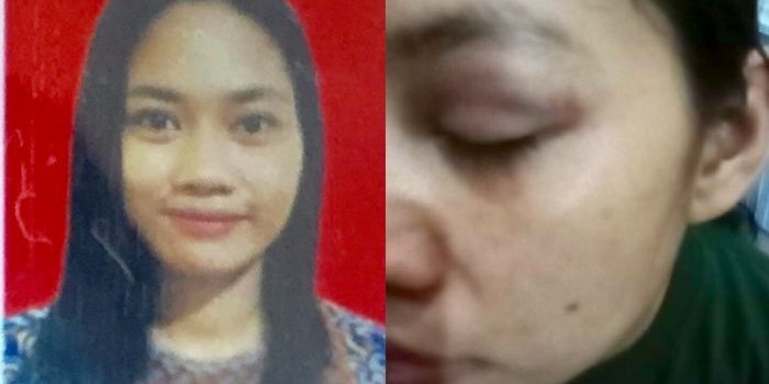 ibu-3-anak-yang-dikabarkan-hilang-laporkan-suaminya-ke-polrestabes-surabaya-atas-dugaan-kdrt