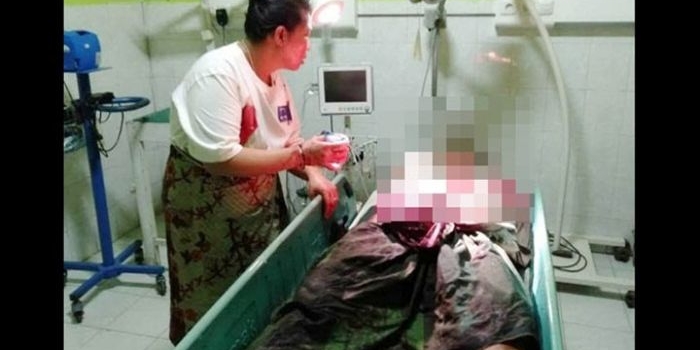 Misnayan sedang dalam perawatan medis di RSUD Slamet Martodirdjo Pamekasan. Korban mengalami luka bacok cukup parah.