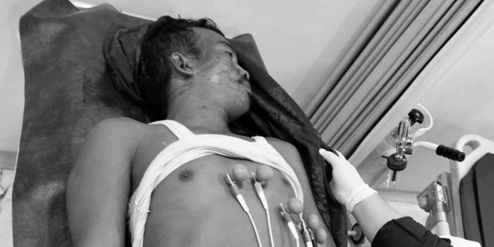 pekerja-proyek-diduga-tewas-terjatuh-di-area-pembangunan-ponpes-dalwa-pasuruan