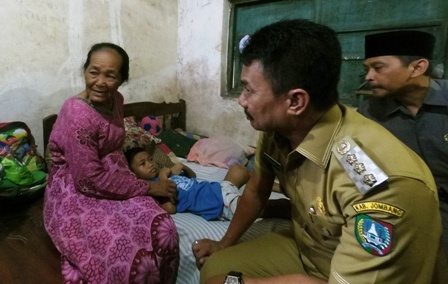 Bupati Jombang Nyono Suharli menjenguk Agus, bocah penderita tumor tulang jinak di rumahnya. 