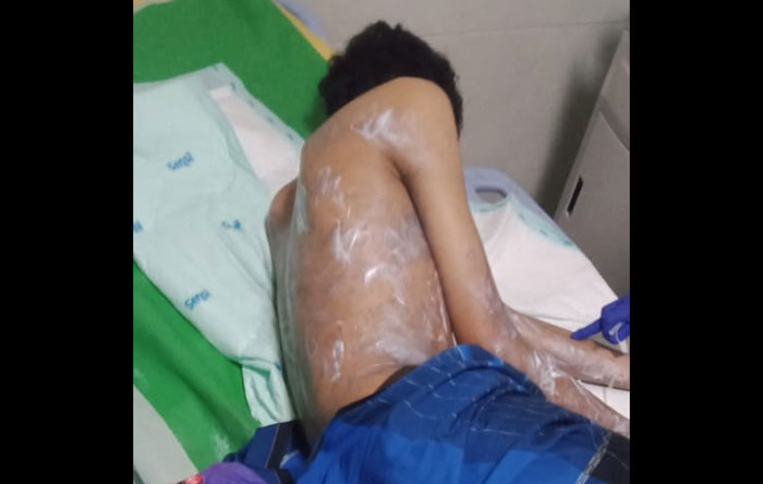 Tak Terima Anak-anaknya Disiram Air Keras, Warga Taman Sidoarjo Kepung CV Mentari