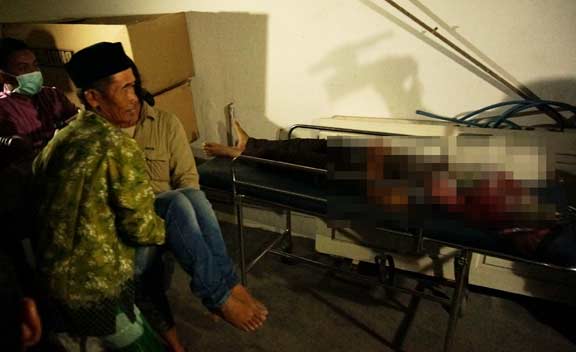 BERNASIB MALANG: Korban saat dievakuasi ke puskesmas usai tertimpa pohon. foto: rony suhartomo/ BANGSAONLINE