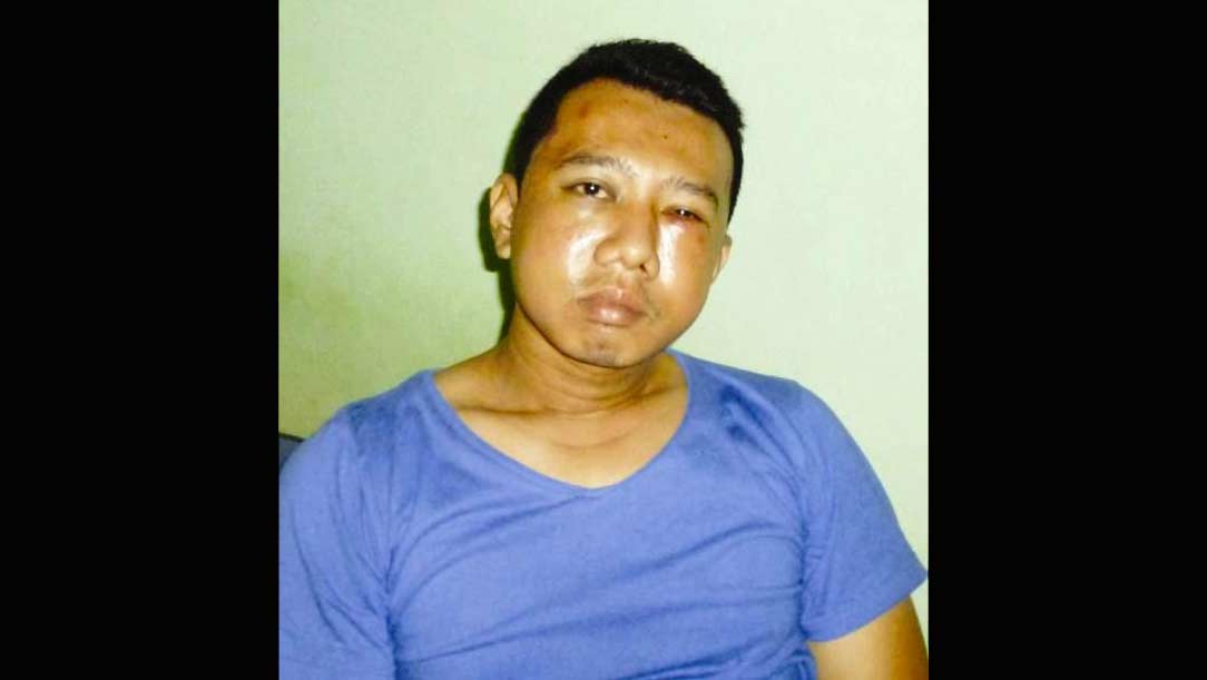 Wartawan di Mojokerto Dihajar Orang tak Dikenal, Diduga Soal Pemberitaan Dugaan Kasus Korupsi