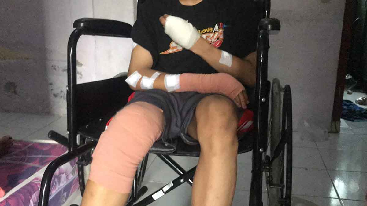 Kondisi korban DWP (16) asal Desa Tawangsari, Taman, Sidoarjo saat ditemui di rumahnya.