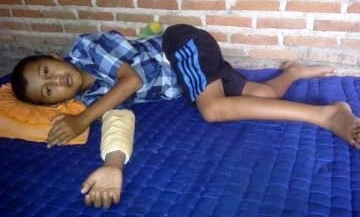 Ahmad Sandi dengan perban di tangan akibat dianiaya oknum TNI. Foto: soewandito/BangsaOnline.com