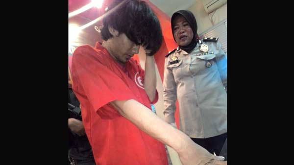 Tersangka curas yang ditembak petugas karena melawan. foto: ekoyono/ BANGSAONLINE