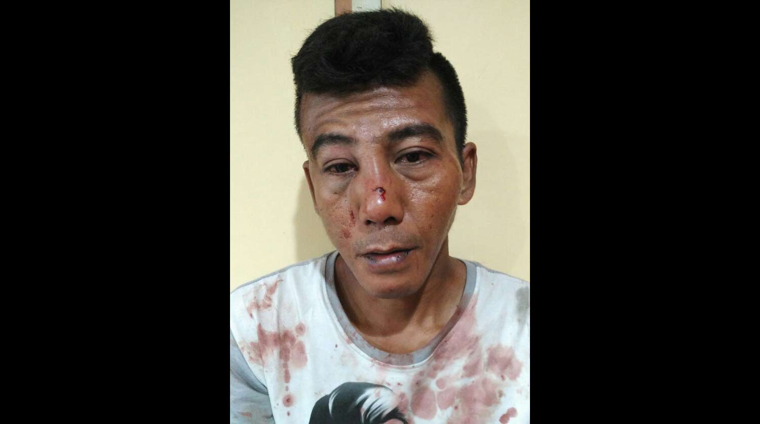 Rudy babak belur setelah ditangkap dan dihajar massa karena curi kotak amal.