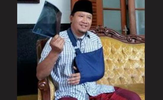 Bupati HM Irsyad Yusuf menunjukkan foto rontgen. foto: AAN WIJAYANTO/ BANGSAONLINE