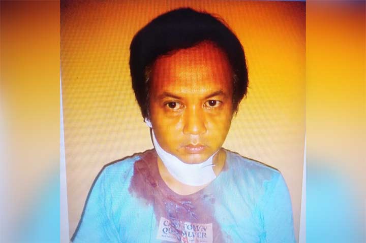 Korban usai mendapatkan perawatan.