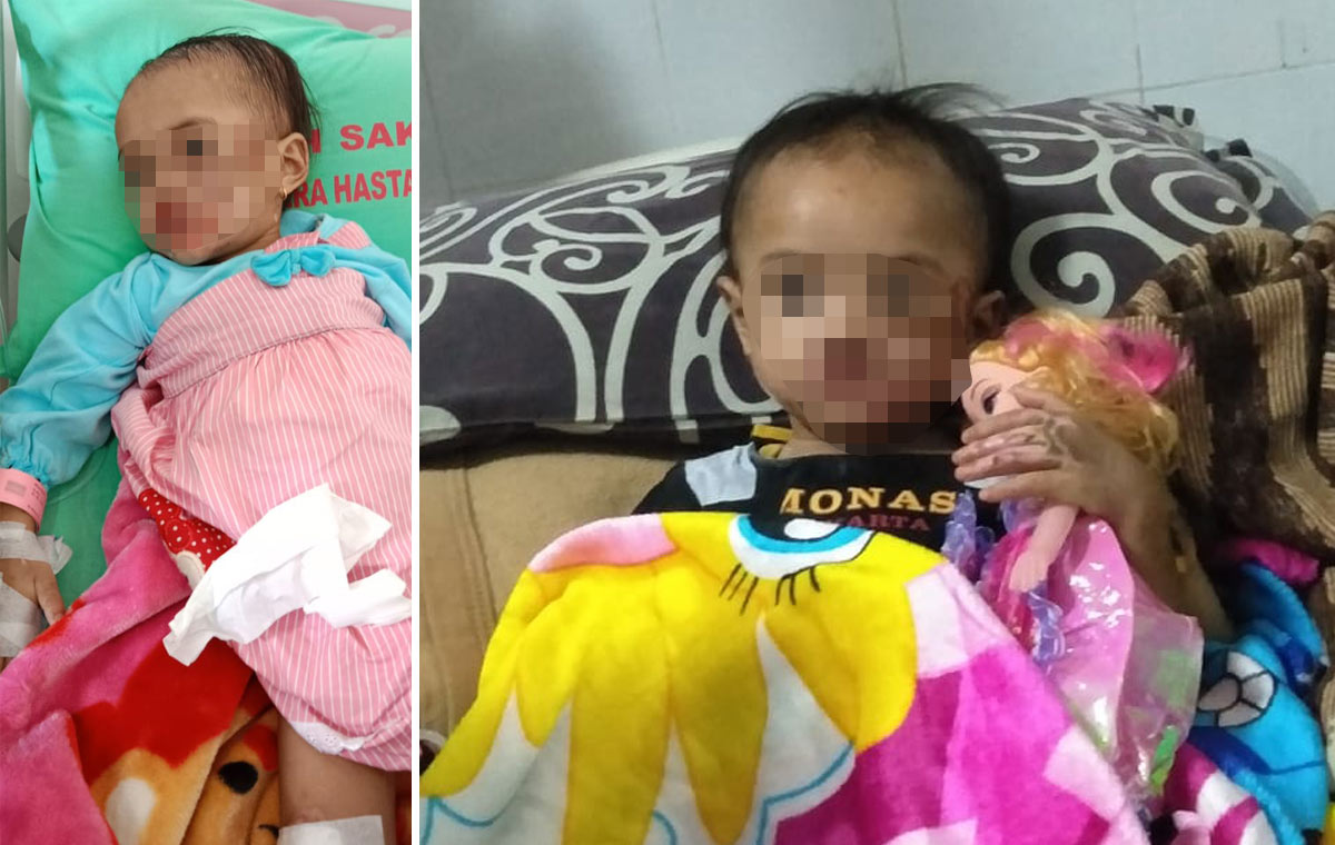 Bayi 2,5 Tahun di Kota Batu Dianiaya Calon Suami Ibunya: Disiram Minyak Panas, Dipukul, Bibir Sobek