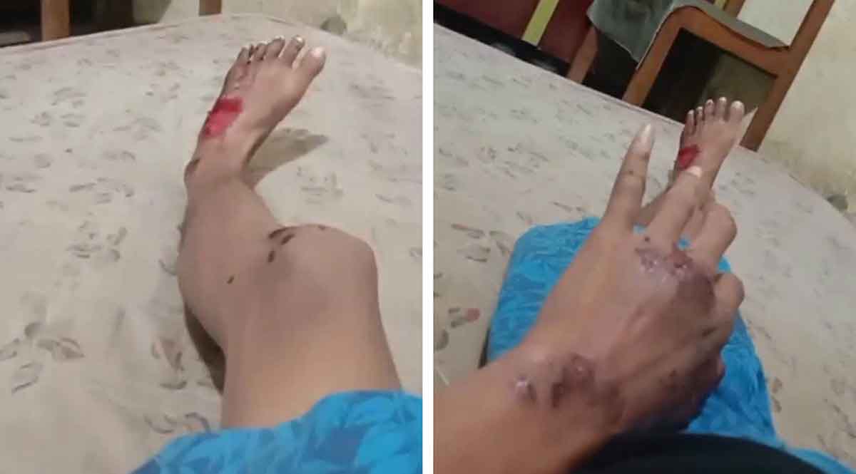 Korban pembacokan gangster di Surabaya.