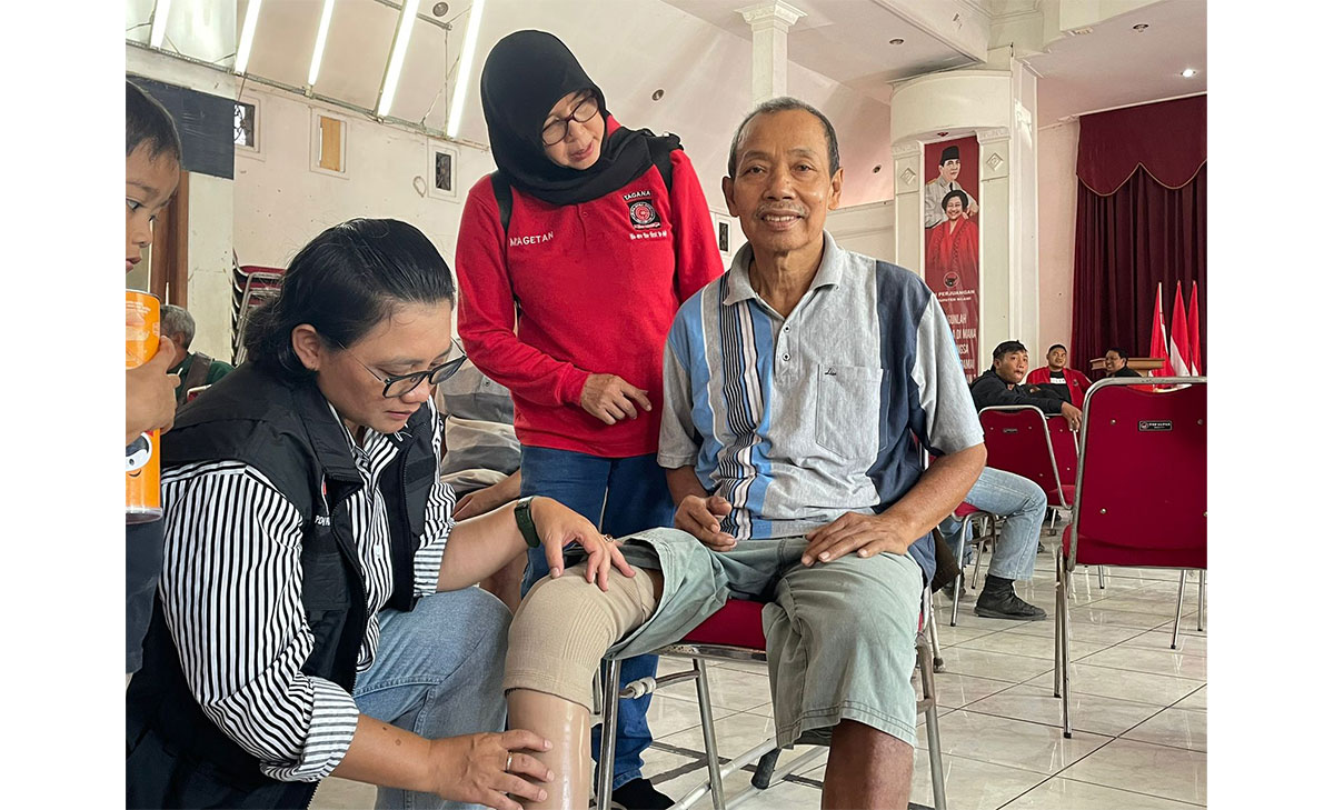 Salah satu penyandang disabilitas yang mendapatkan bantuan kaki palsu dari Diana Sasa.
