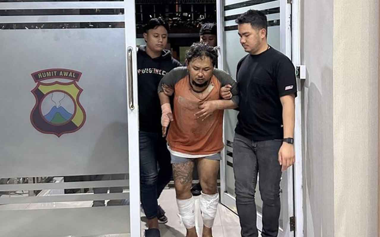 Pelaku Syahrama (38) dalam kondisi kakinya diperban akibat tembakan yang dilakukan oleh anggota Satreskrim Polres Gresik saat penangkapan di rumahnya di kawasan Menganti.