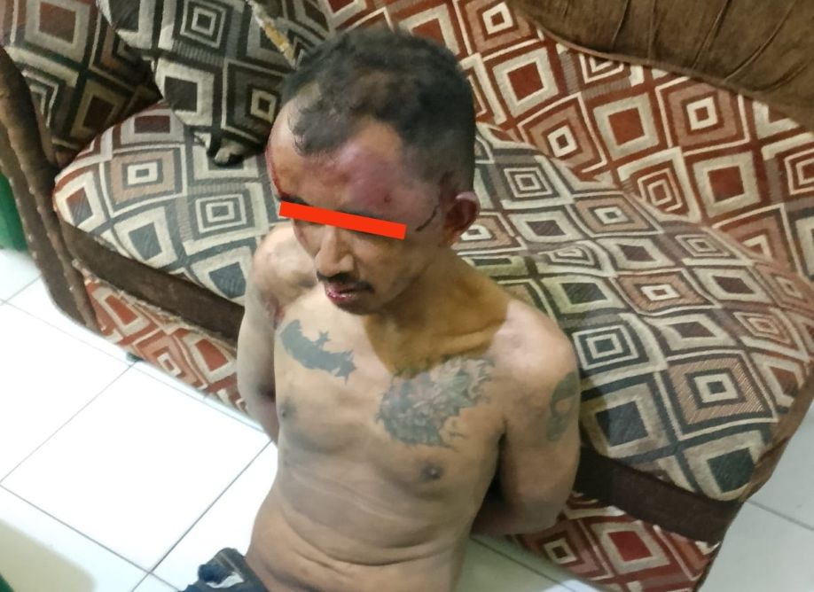 Kondisi pelaku yang babak belur usai jadi bulan-bulanan warga