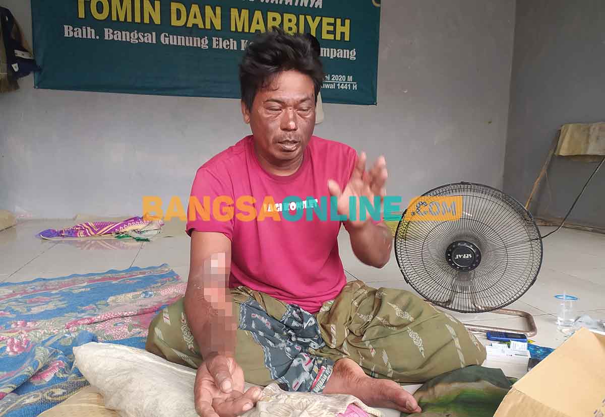 Korban kebakaran dari sumur bor bercampur gas alam di Sampang, Matderah. Foto: MUTAMMIM/BANGSAONLINE