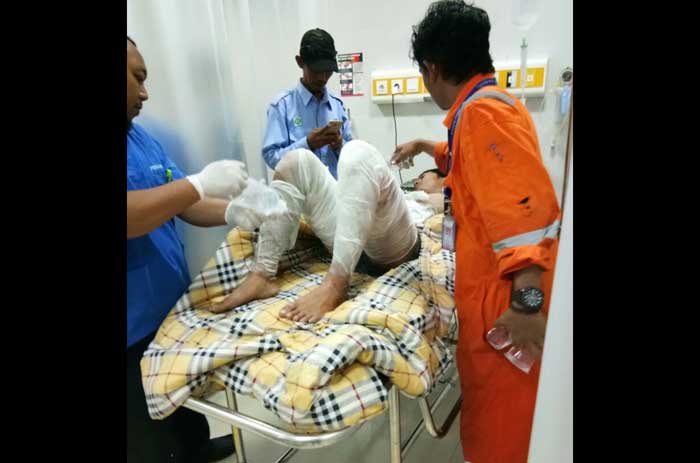 Korban luka bakar saat dirawat di RSUD Dr. Koesma.