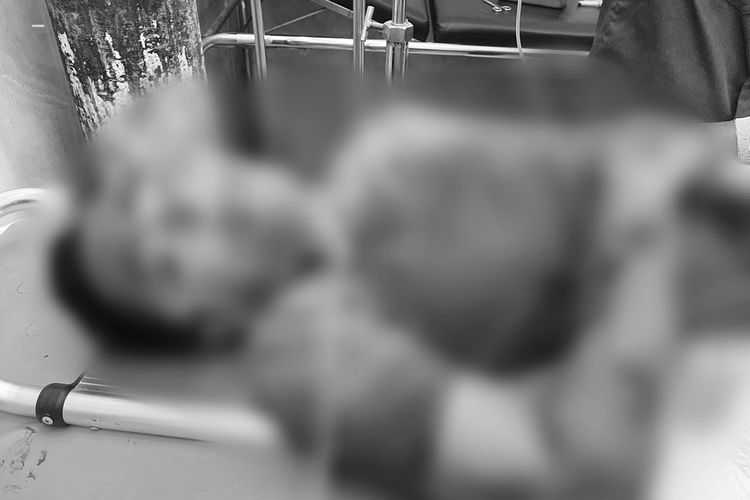 Kondisi korban saat dilarikan ke UGD RSUD Syamrambu