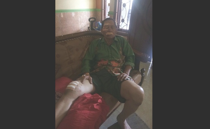 KORBAN BEGAL: Adenan mengalami luka sobek, di bagian kepala, mata, tangan dan lutut di bagian kanan. 