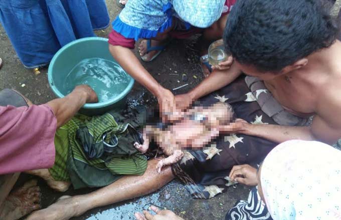 Kondisi bayi merah yang dievakuasi dari dalam septic tank langsung dilarikan ke Puskesmas terdekat. foto: FUAD/ BANGSAONLINE
