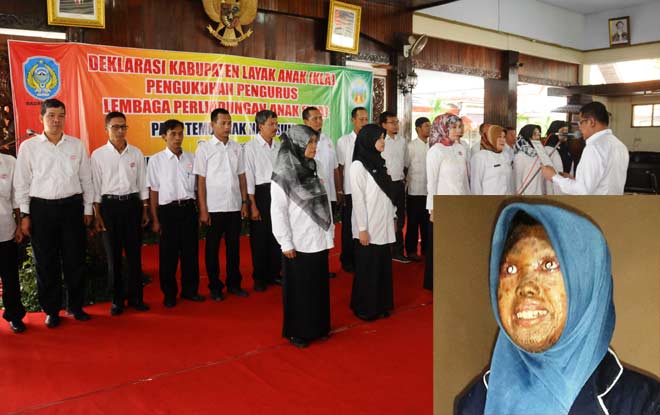 Bupati Nganjuk Drs H Taufiqurrahman mengukuhkan pengurus LPA. Inset: Maya siswi NTsN menderita penyakit kulit.