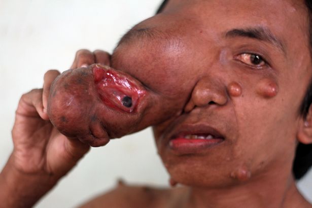 Allohu akbar.... semoga Alloh memberikan kesabaran. foto: mirror.co.uk