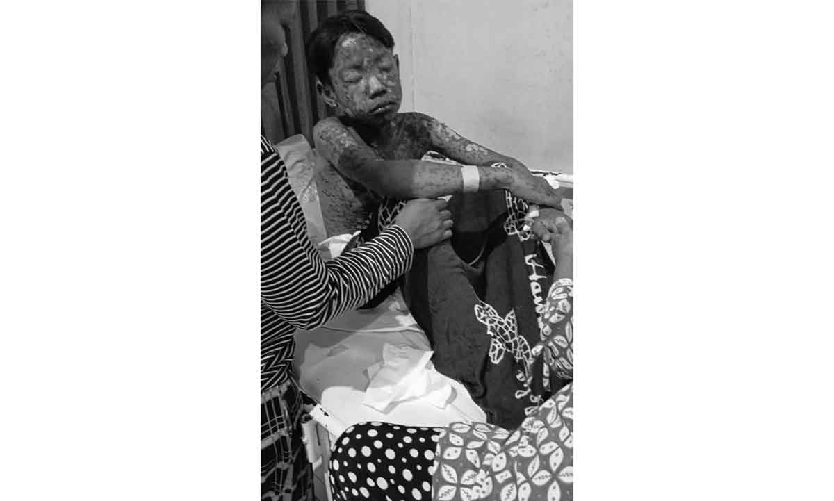 Remaja dari Kecamatan Ambulu, Jember, saat mendapat perawatan di rumah sakit.
