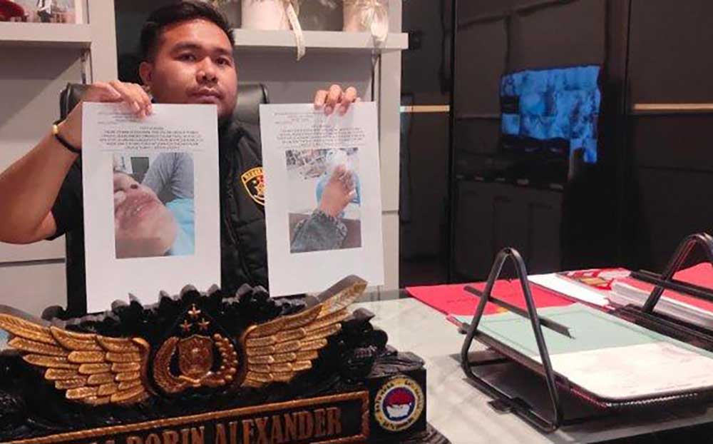Kasatreskrim Polres Tuban, AKP Dimas Robin Alexander, menunjukkan foto korban saat menjalani visum.
