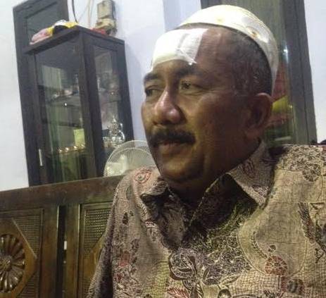 BEKAS LUKA – Dahi korban yang diperban usai kejadian. foto: nanang/BangsaOnline