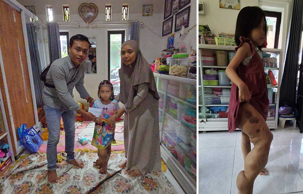 Utusan dari Yayasan BIP saat memberikan bantuan kepada Anindita Syafia Azzahra.