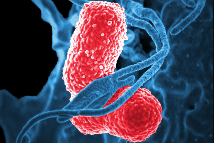 Benarkah Mandi Malam Bisa Sebabkan Pneumonia? Ini Penjelasan Dokter. Foto: Ist