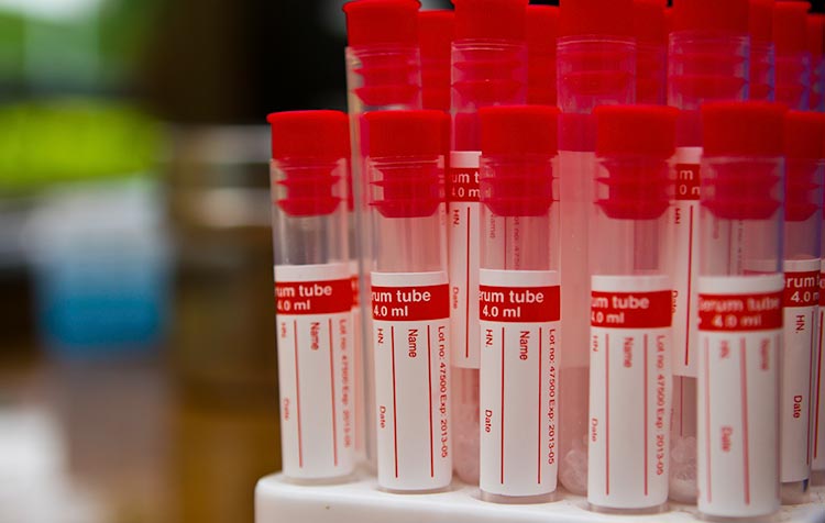 Nihil, Donor Plasma Darah Belum Direspons Pasien Sembuh Covid-19