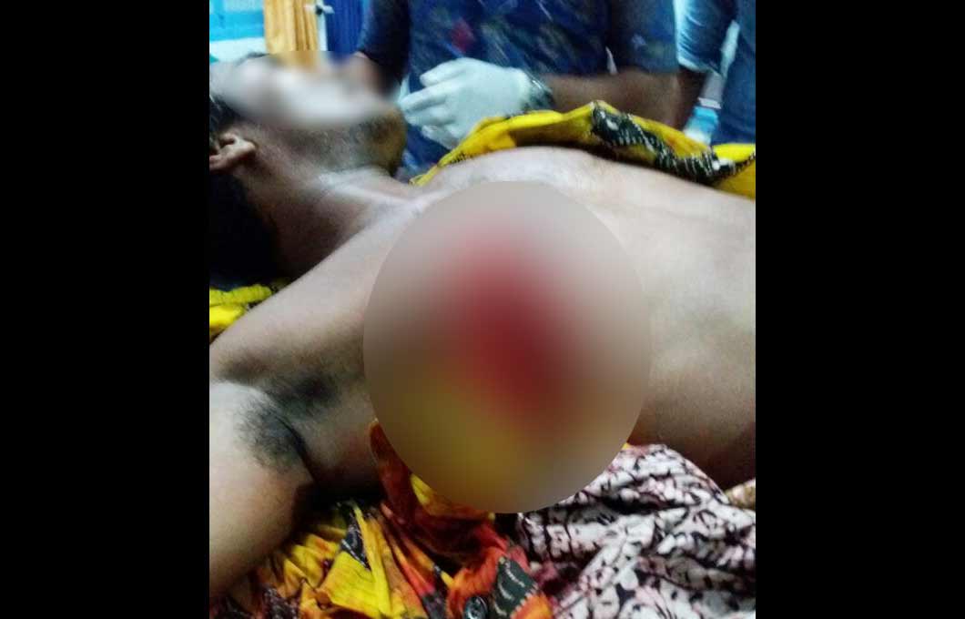 Salah satu korban tewas saat dibawa ke Rumah Sakit.