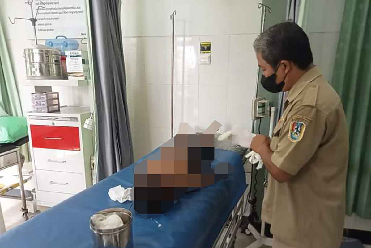 Korban MID (8), setelah dilarikan ke Puskesmas Temandang, Senin (24/10/2022).